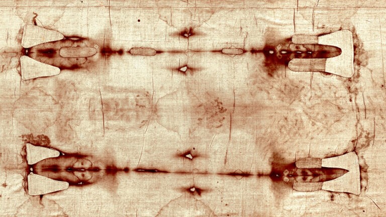 Sindone Lipomo